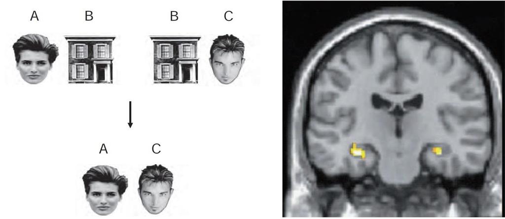 A hippocampus és agytörzsi kapcsolatai