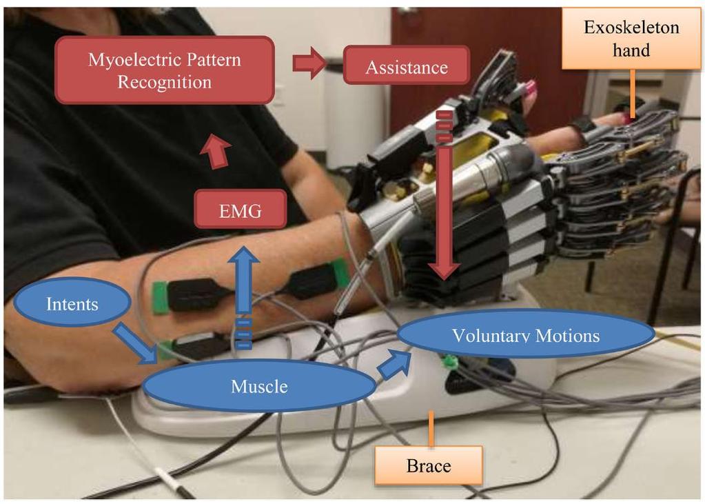 Myoelektromos kontrol: robotkar-asszisztált