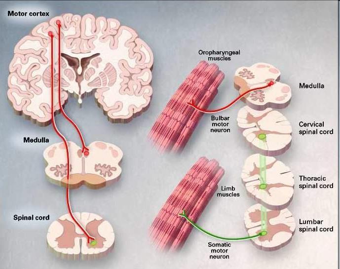 A motoneuronokat érintő kóros elváltozások Alsó motoneuron: izmot beidegző Felső motoneuron: cortex Perifériás bénulás (paresis): - Alsó motoneuron károsodás - Petyhüdt (flaccid) izom -