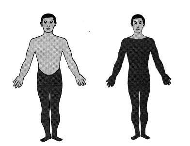 Ami a spinalis shock oldódása után nem áll helyre: - Akaratlagos mozgások - Járás, állás - Izomtónus megfelelő szabályozása Paraplegia: két végtagra