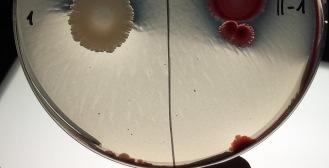 A kísérleteink alapján sikerült szelektálnunk olyan Lactobacillus törzseket, amelyek a genetikai információk alapján képesek lehetnek kitináz termelésre, ezáltal jelentős penészgátlásra.