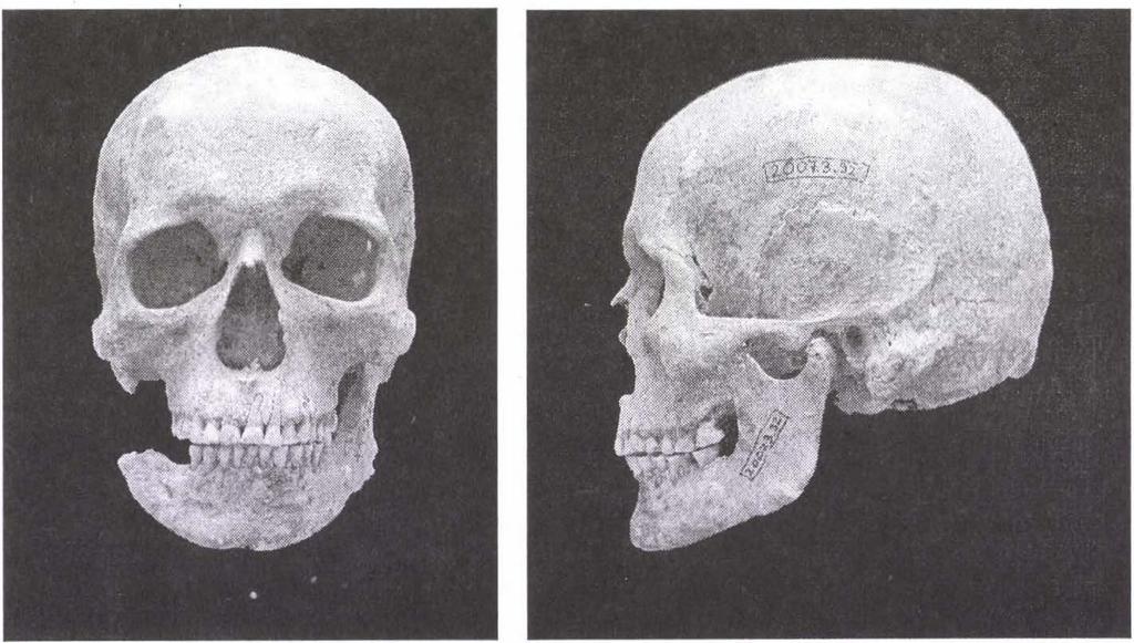 1. ábra: 159. sír, adultus férfi (elöl és oldalnézet). Figure 1: Grave 159, adult male (frontal and lateral view). 2.