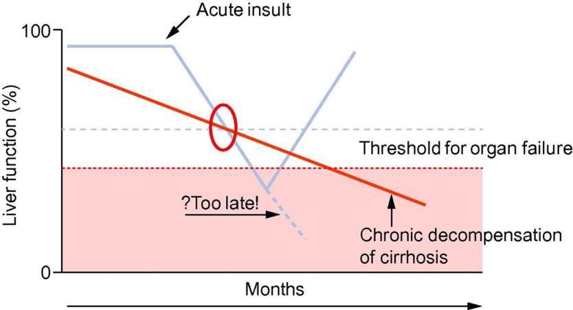 Acut-on- chronic failure (ACLF) Journal of