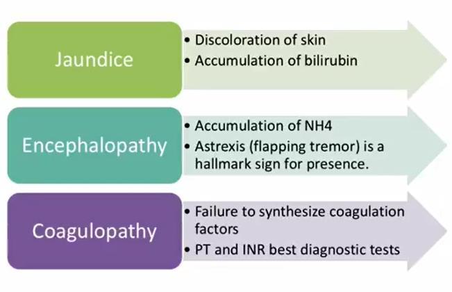 Akut májelégtelenség vezető klinikai tünetei Icterus Bilirubin felhalmozódása Bőr elszíneződése Hepaticus encephalopathia