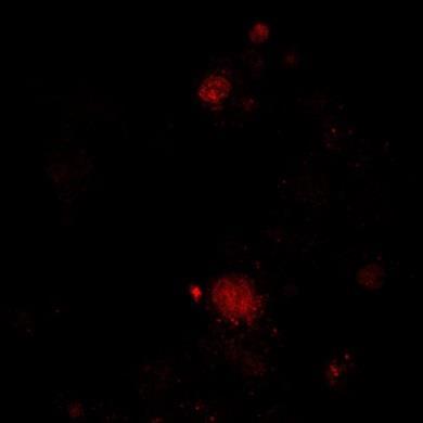fluoreszcens