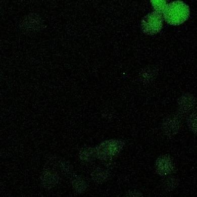 kezelés: 25 µm,