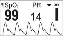 9.C ábra PI% : Perfúziós index szimbólum; 9.