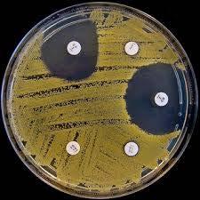 indokolja) Ideális esetben: bakteriológiai- és rezisztencia vizsgálat