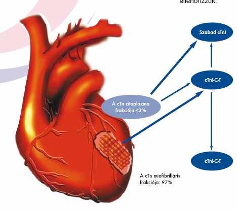 A ctn komplex: A ctn myocardium sérülés után szabadul fel, intakt szívizom esetében nem mutatható ki.