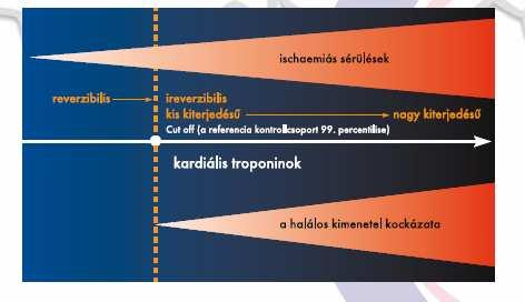 Klinikai jelentısége A ctn bármilyen mértékû emelkedése nagy valószínőséggel miocardiális nekrózis jele.