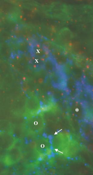 35. ábra VIP/NOS/NMDA receptor NR1 alegység hármas fluoreszcens immunfestés 18 hetes humán magzati vékonybélbıl készített wholemount preparátumon.
