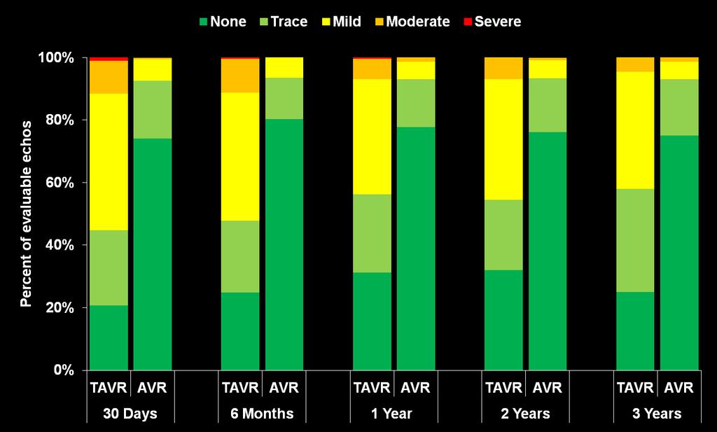 Paravalvular Aortic Regurgitation