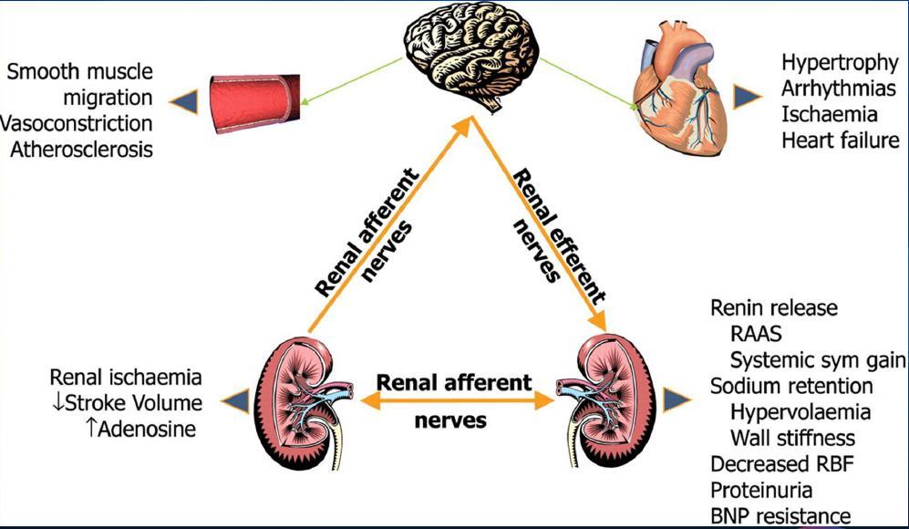 Hypertonia - RDN Cadaver tanulmányok: renalis idegek 70%-a a vesearteria