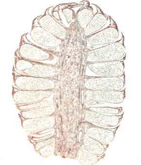 ? 1N POLLEN