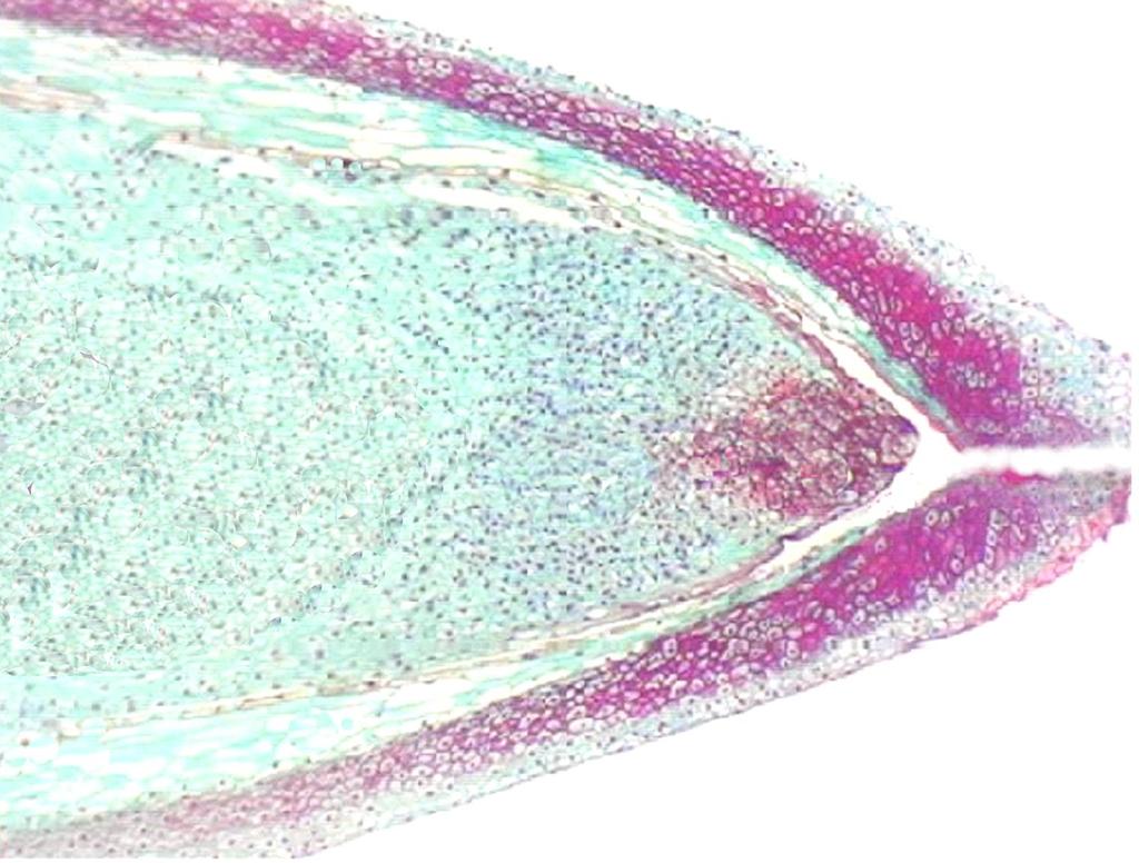OVULE MEGASPORANGIUM MICROPYLE?