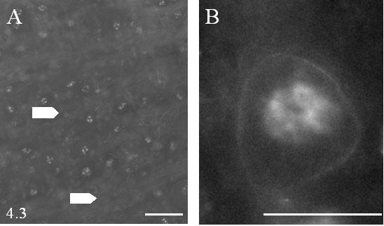 erıs Kv1.1-pozitivitást mutató bushy-neuronok kerek sejttestjei. Valamennyi, a jelen és a következı ábrán bemutatott felvétel, a nucleus cochlearis ezen területén készült.