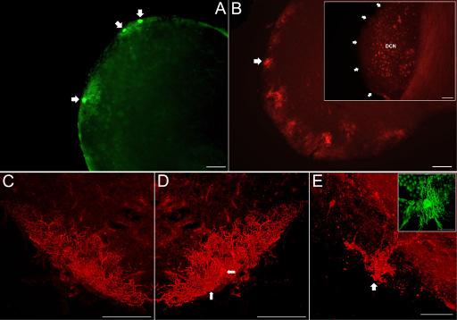 3.2.2. Eredmények A nucleus cochlearis komplex egyik legérdekesebb sejttípusát a Purkinje-szerő sejtek képezik (16. ábra).