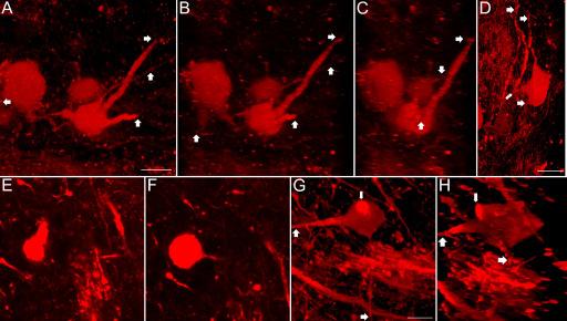 Az octopus-neuronokat meglehetısen változatos morfológiai jegyeket mutató, de általában kissé elnyújtott sejttesttel rendelkezı sejtekként azonosítottuk, a soma átlagos átmérıje 26 ± 4 µm volt (az
