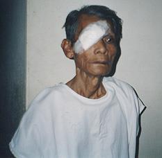 SightFirst Kína Program