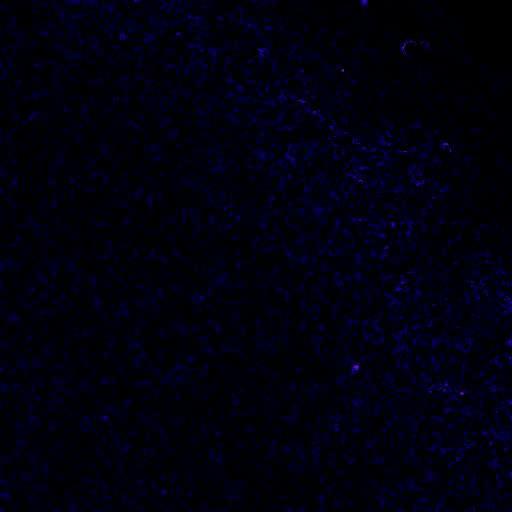 Ca++ waves Nucleus accumbens, Patkány agyszelet