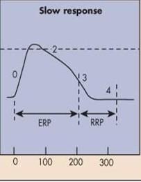 Szakaszok: T típusú Ca2+ áram: lassú depolarizáció (0) Legdepolarizáltabb részeken L áram is aktiválódik T áram inaktiválódik, megkezdődik a repolarizáció (2) K+ áramok (késői K+