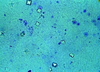 A kálcium anyagcsere vizsgálatának módszerei I. 1. Laboratóriumi vizsgálatok Szérum - kálcium (2.23-2.