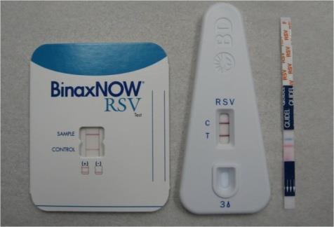 Mikróba, mint antigén kimutatásán alapuló tesztek - POCT vizsgálatok Módszer: agglutináció, immunkromatográfia (szerológiai vizsgálatok) Példák: Légúti minták: