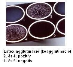Latex agglutináció (koagglutináció) 2.és 4.
