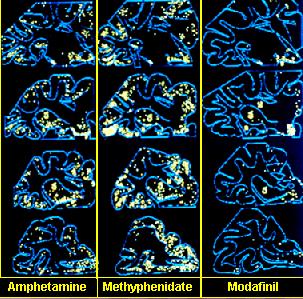 Modafinil szelektív kötődése Immunfluorescens vizsgálat C-fos gén az amphetamin, methylphenidate,