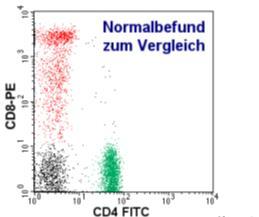 Immunológiai vizsgálatok: HIV-fertőzöttek diagnosztizálása és monitorozása Diagnózis: szerológiai vizsgálatok (pl.