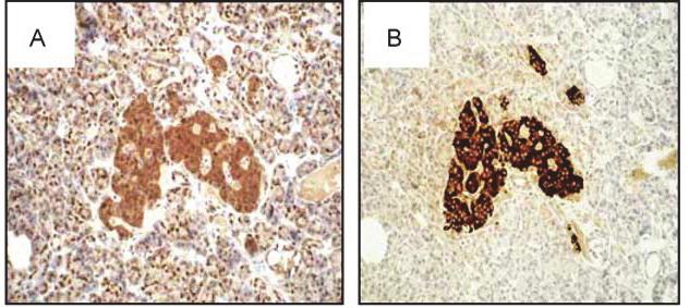 Az egyik irány: D-vitamin hiány obezitás/metabolikus zavar D-vitamin inzulinszekréció β-sejtekben D-vitamin receptor