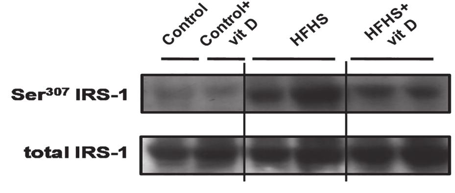 glukózmetabolizmusa 3 D-vit gyulladás