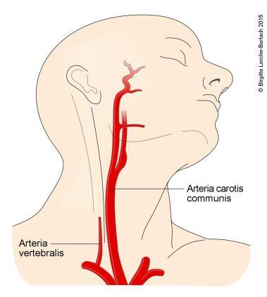 !) - Itt is vasovagális, cardioinhibitoros, valamint kevert forma lehet - Ha