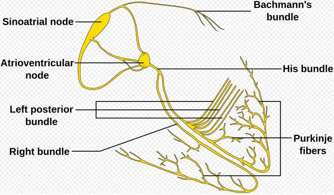 Sinuscsomó diszfunkció 1. Sinus bradycardia 2. Sinus arrest 3.