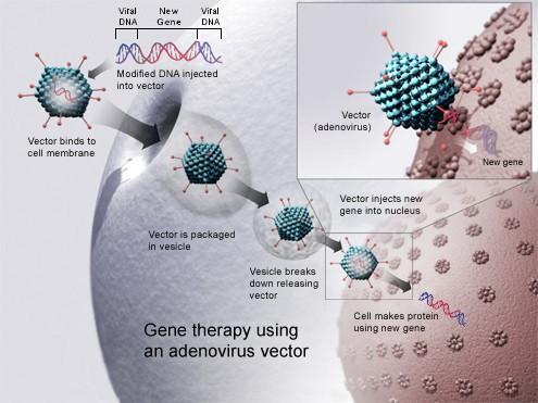 Gene Therapy Vector Origin of