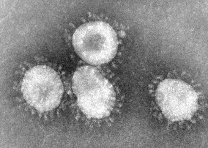 A kórokozó / a betegség A sertés Corona vírusai Variable group RNA viruses New Delta coronavirus Csak egy szerotípus ismert PEDV