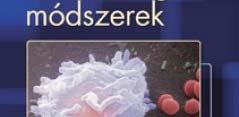 4. Az antigén és ellenanyag kapcsolódásán alapuló