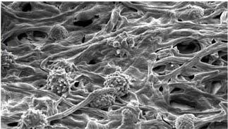 Nem csak baktériumokból állnak Aspergillus biofilm. Repülőgépen talált kevert biofilm.