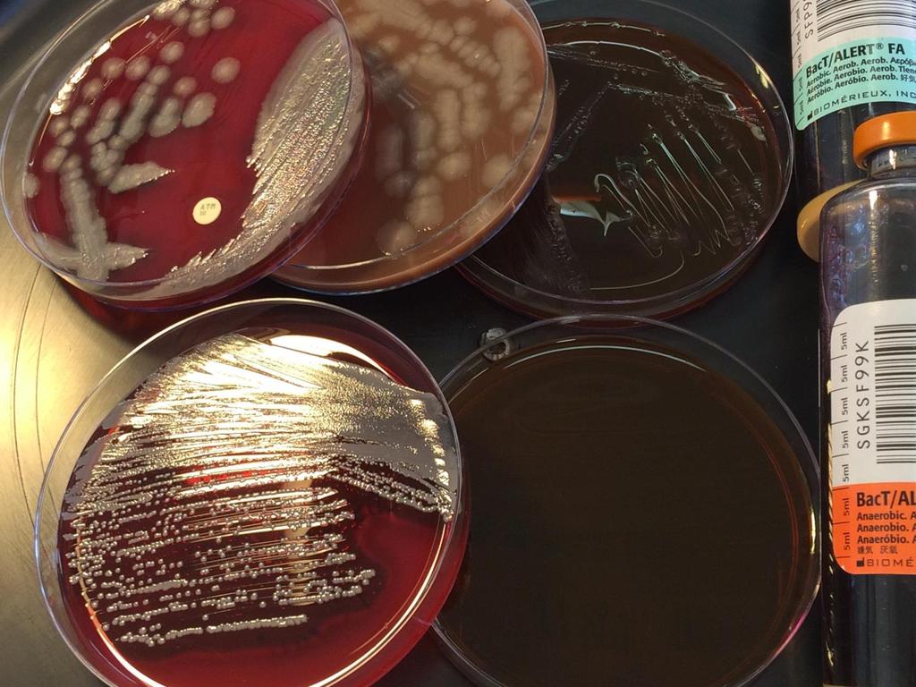 A HK palackok megválasztása Aerob, anaerob palack Speciális gombatáptalaj antibiotikum