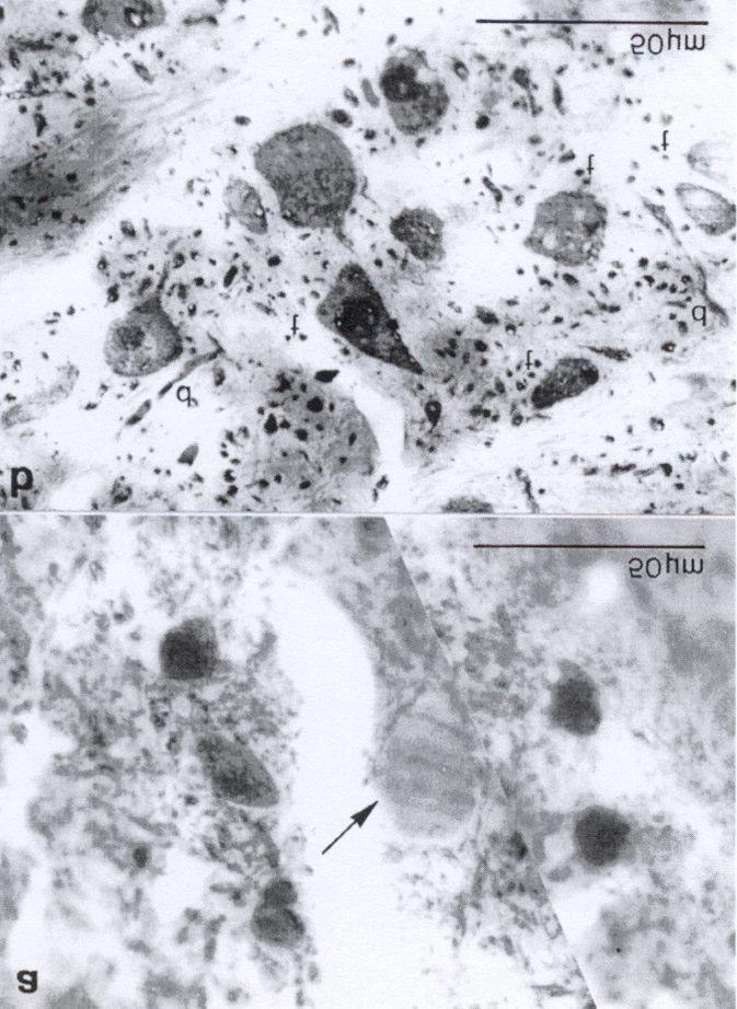 9. ábra: GABA immunhisztokémiával készült nbor preparátum fénymikroszkópos felvétele.