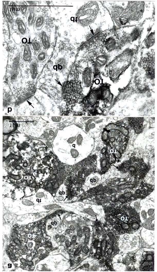 13. Ábra: Elektronmikroszkópos felvételen (a, b V\QDSWLFXV PH]N OiWKDWyN GHQGULW terminálisokkal (dt), dendrit nyúlványokkal