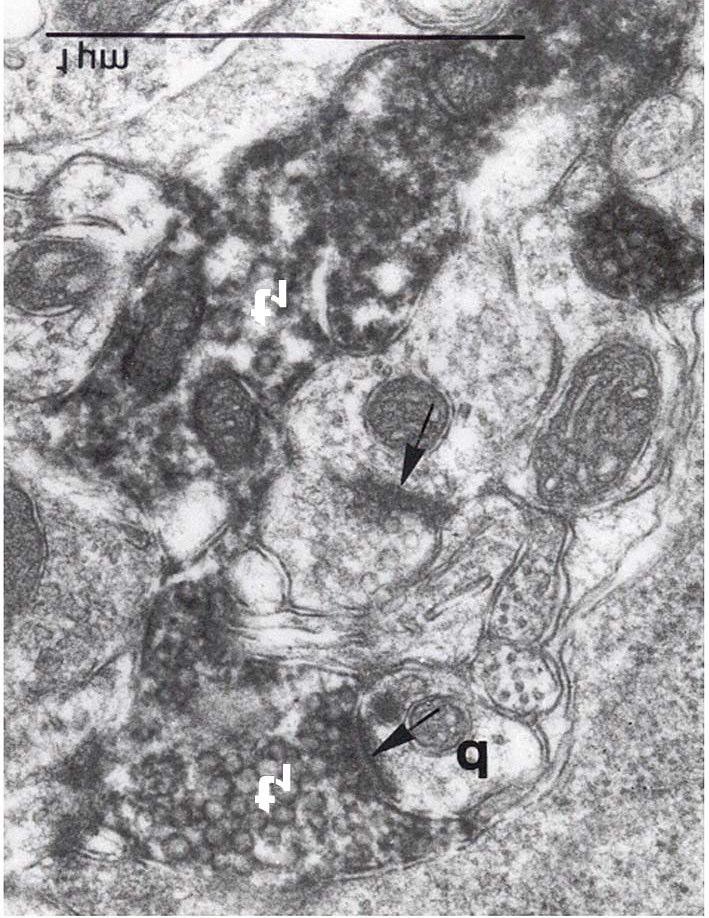 27. ábra: A nlmmc elektronmikroszkópos felvételén a BDA-val jelölt opticus terminálisok