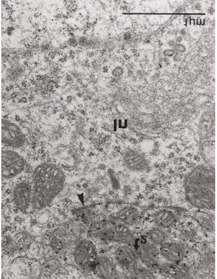 29. ábra: A nlmmc elektronmikroszkópos felvételén GABA immuno-pozitív terminális (t 2 ) látható, amely