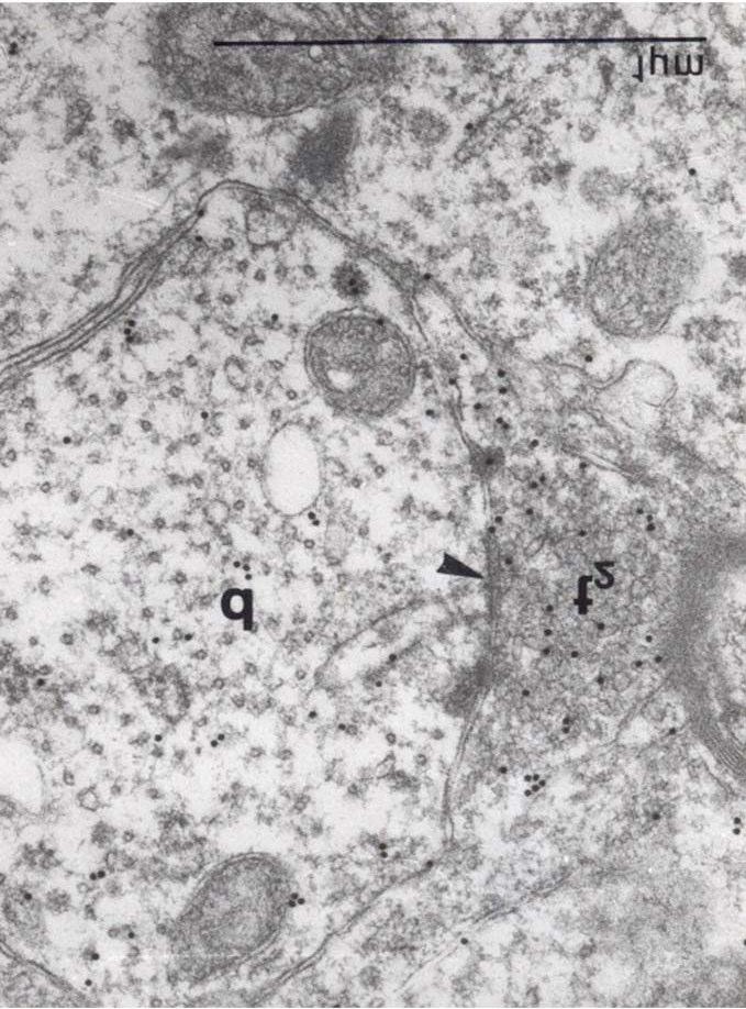30. ábra: A nlmmc elektronmikroszkópos felvételén egy GABA immuno-pozitív terminális (t 2 )