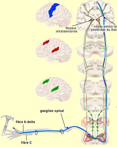 Anterolaterális (Spinothalamicus) pályarendszer 94. FÁJDALOMÉRZÉS Nociceptorok SI kéreg hiányában van fájdalomérzet?