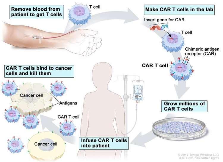 CAR-T Chimeric Antigen receptor