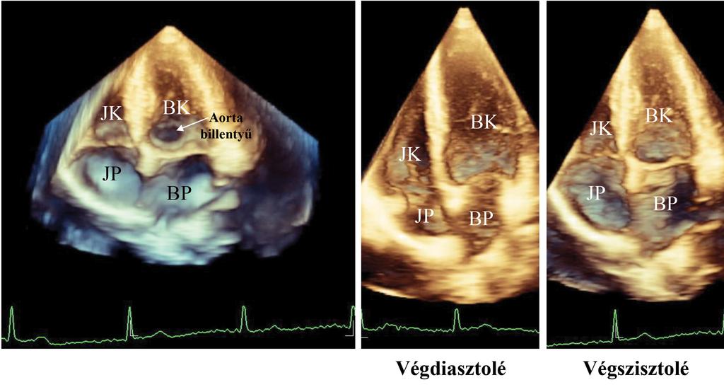 A szívciklusnak megfelelően a szisztolés rezervoár, a kora diasztolés conduit és a késő diasztolés aktív kontrakció idején mérhető strain (A) és strain rate (B) paraméterek az ábra szerint mérhetők,