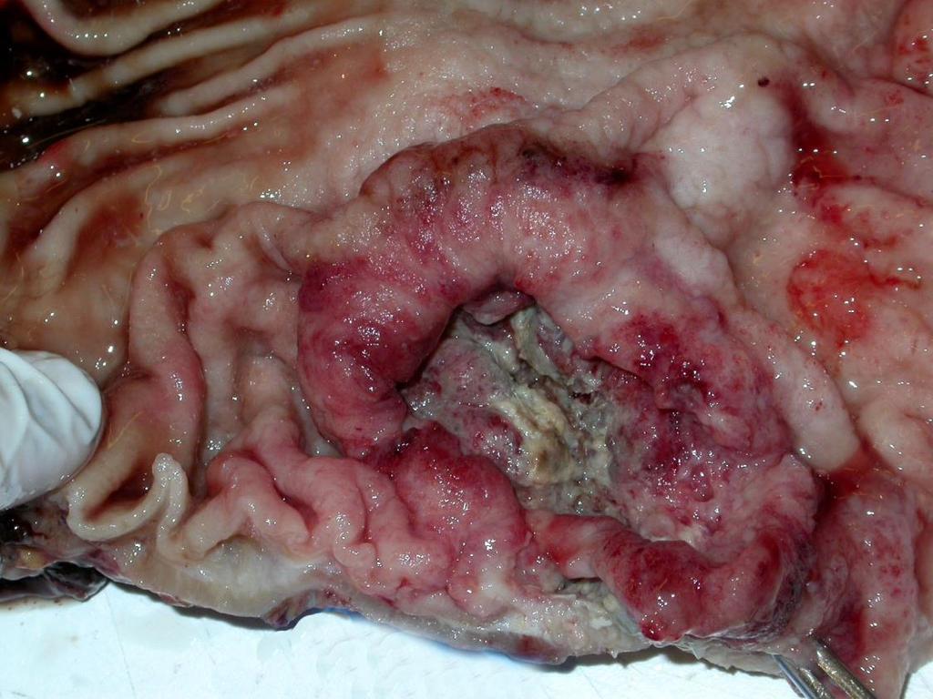 Intestinalis