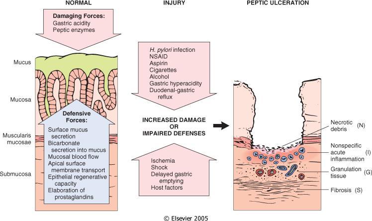 PEPTIC