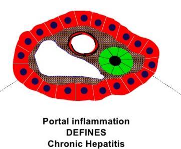 hepatitis?